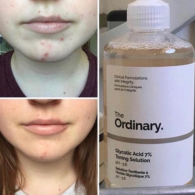 The Ordinary Glycolic Acid 7% Toning Solution | Solución Tónica